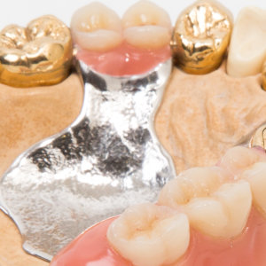 Sell Dental Gold